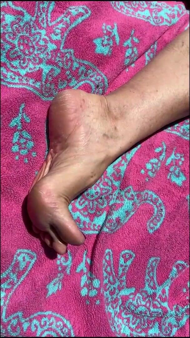Aunt Ann: Fan Request Granny Naked in Sun Shows Dirty Rough Soles &amp;...