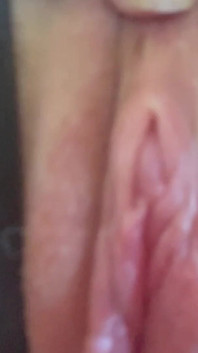 Ombligo perforado