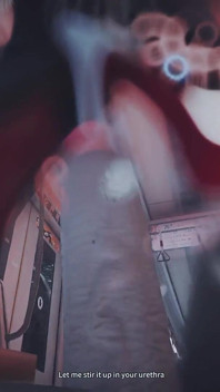 B010 CBT 尿道探测