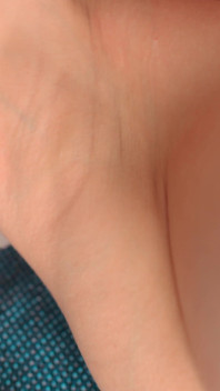 The Skin of My Armpits Is so Delicate
