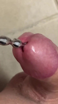 Uretrální vložení