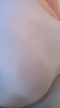 Erotis Bulging
