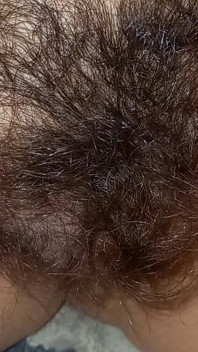 Shorts Hairy
