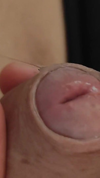 Amazing Pre Cum Glans.
