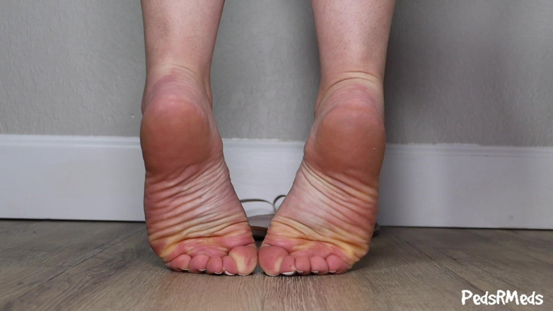 PedsRMeds: Barefoot Mel Tippy Toes and Wrinkled Soles