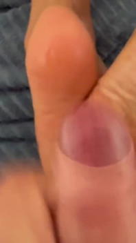 Kerja Kaki Ekstrem Dan Menginjak Bola