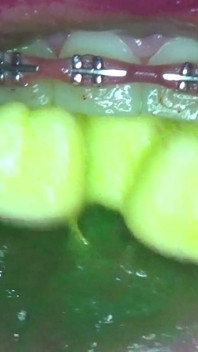Swallowing Gummy Bears in Pairs!!
