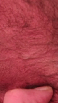 I Spread My Anal Opening.