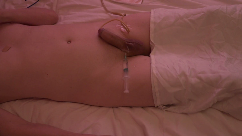 Wibblewang: Testiculaire injectie
