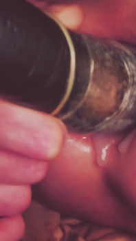 Dilatation Anal