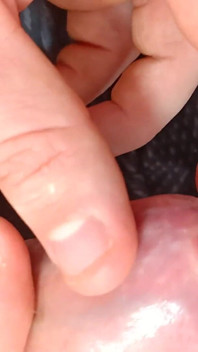 Tight Foreskin Large Cock Play- Playing with My Uncut Foreskin Phimosis Cock