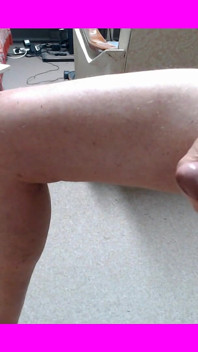 Cum Complication