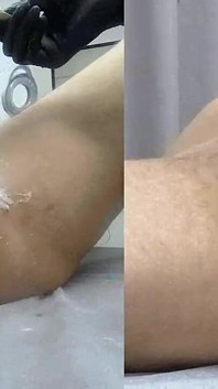 Pria lagi waxing memeknya #36 bagian-3