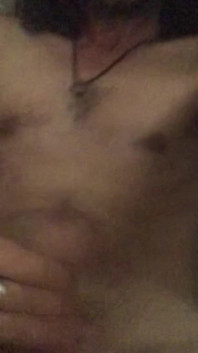 Stroke
