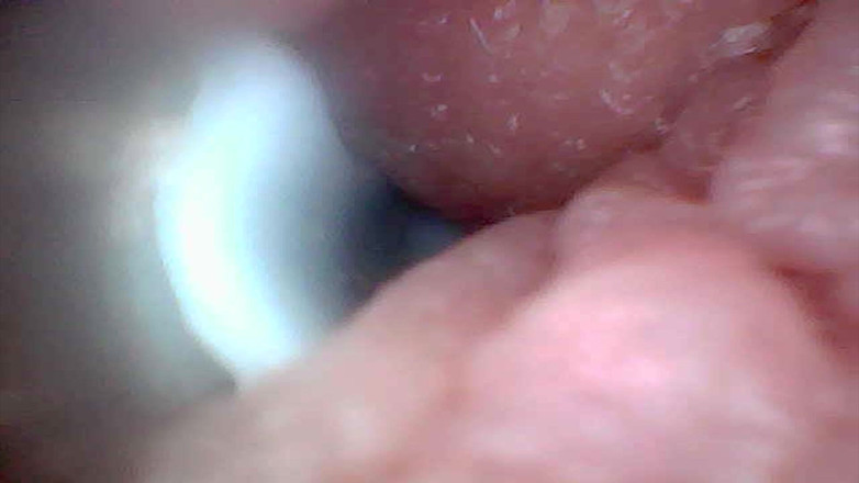 Twittiy: Diamo una sbirciatina nella mia figa succosa insieme (endoscope camera)