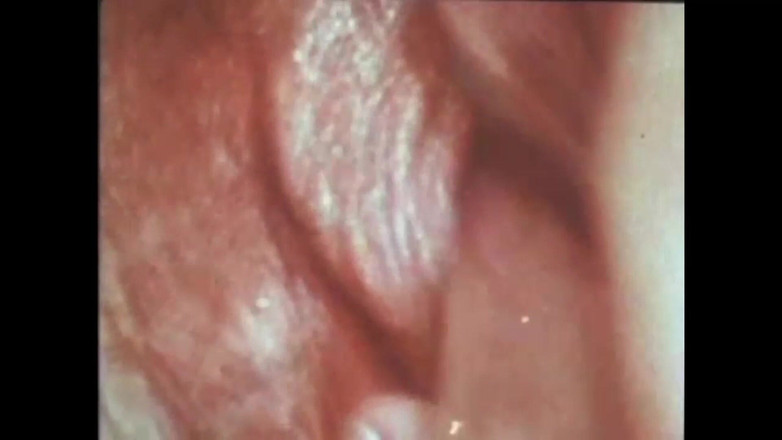 The Unforgettable: Ванесса и Марлен играют с мячами