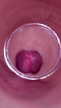 Inseminacja kobiet - kamera wewnętrzna rejestruje głęboki wytrysk mężczyzn
