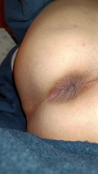 My Anus