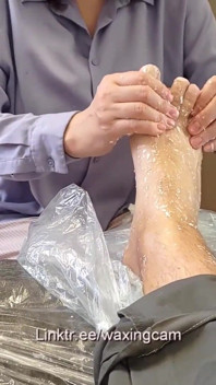 Eldivenli iki hemşire tarafından çoraplı bir erkeğe epilasyon