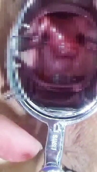 Using a Speculum to Spread an M-woman's Pussy, Anal Training　1/2