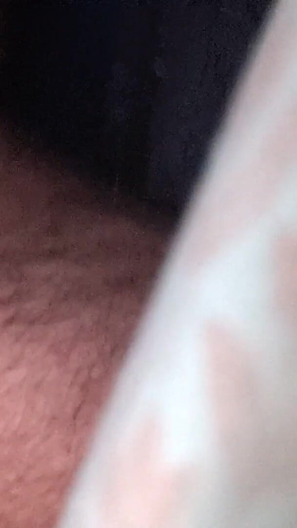 Close up (Karenpads)