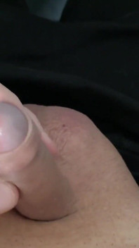 Kleiner Forskin-penis