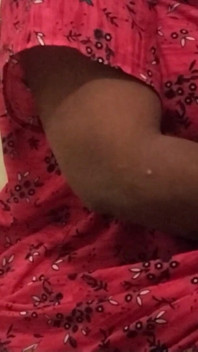 Hot Leg