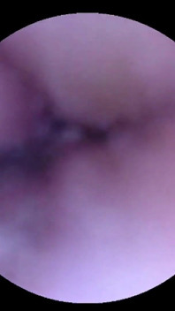 Hana Kano - Extreme Belly Button Exploration Part 2: Suction and Microscopic Observation