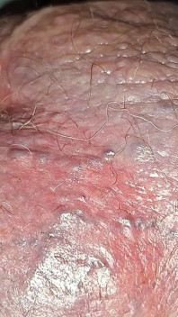 Quái vật trần trụi