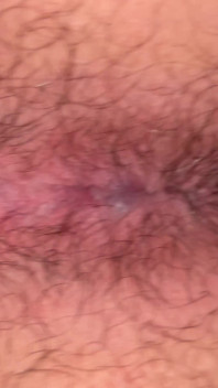 Close up Hairy Hole