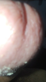 Smegma Big Uncut Smell