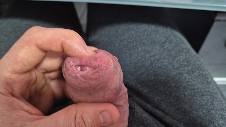 GloomyChase977: तंग फिमोसिस चमड़ी खिंचाव के साथ वीर्य निकालना!