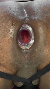 Zadek Gape