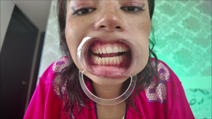 KiyuSweetCrazy: Cheeks Pulled Apart Teeth Exposed