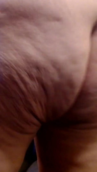 Cellulite nichor