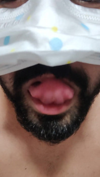 Dickontop