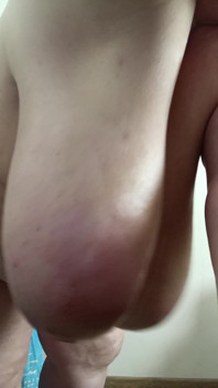 Titties