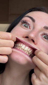 Mouth Stretching & Big Eyes
