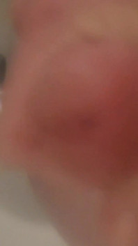 Huge Nut