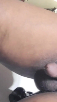 Prostate milking