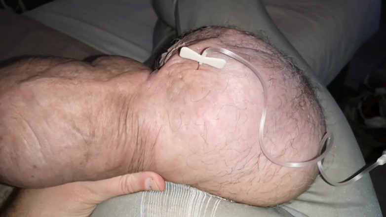 Monster_Meat_: Glukosa dua liter di dalam silikon 1380ccku