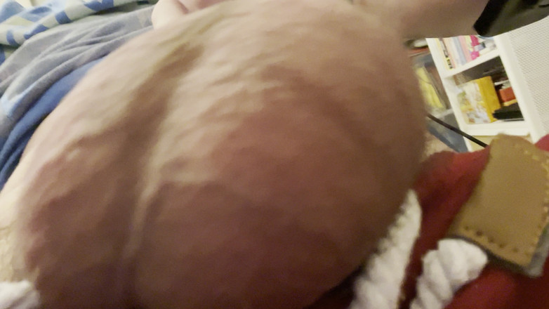 Aimeronds: 물린 것과 젖꼭지 표시