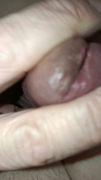Il Mio Meato È Aperto?