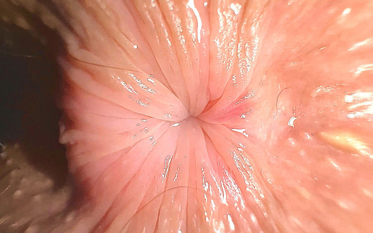 Extreme Close up: Teenage Butthole Is Trying to Kiss You Through the Screen of Your Phone