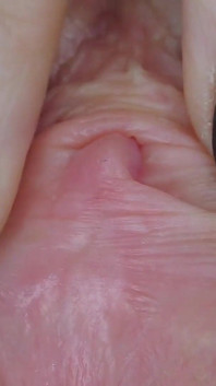 Clitoride e vagina