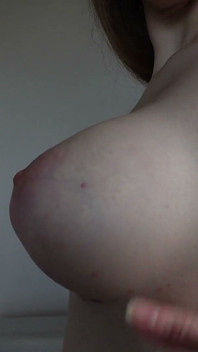 Boobs Progress Update After Reconstruction