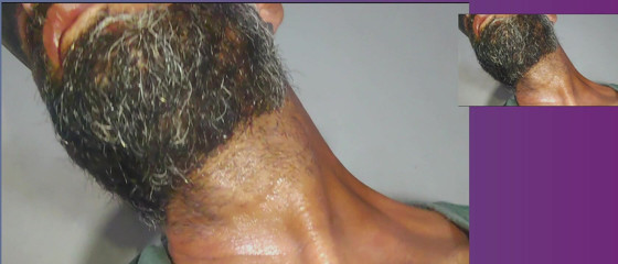 Stink HairyMale: Kết cấu của quần áo