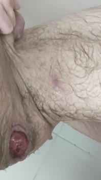 내 영원한 열린 후장을 피스팅하고 피스팅