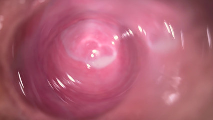 Mia Foster: Mia의 작은 질 깊숙한 카메라