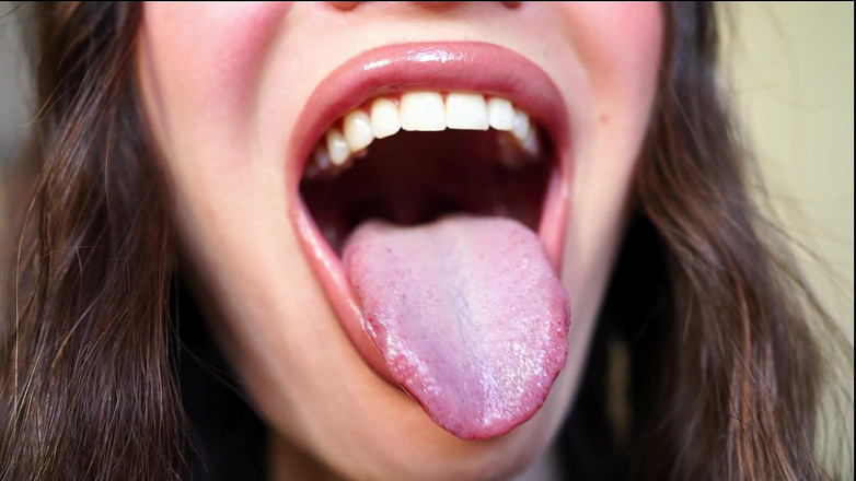 Rarible Diamond: Drool Dripping From My Tongue 5